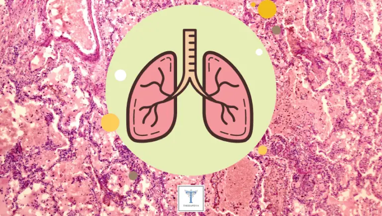 Pneumonie fongique : Informations importantes pour vous … 2023