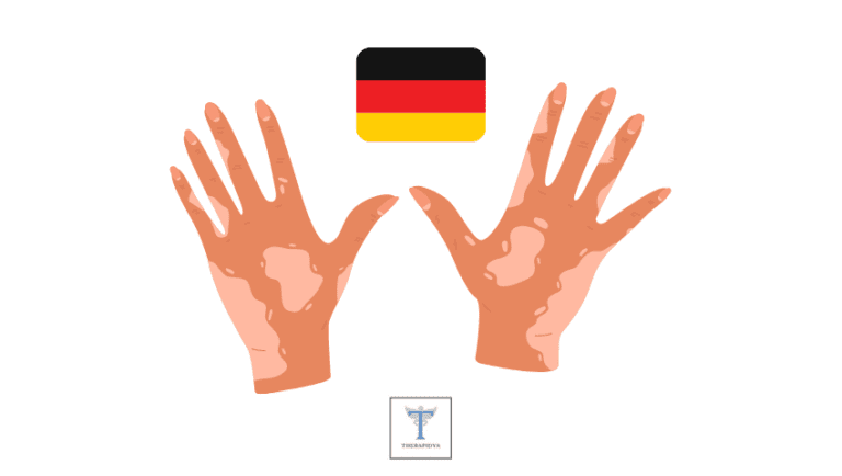 Behandlung von Autoimmunerkrankungen in Deutschland .. 2023